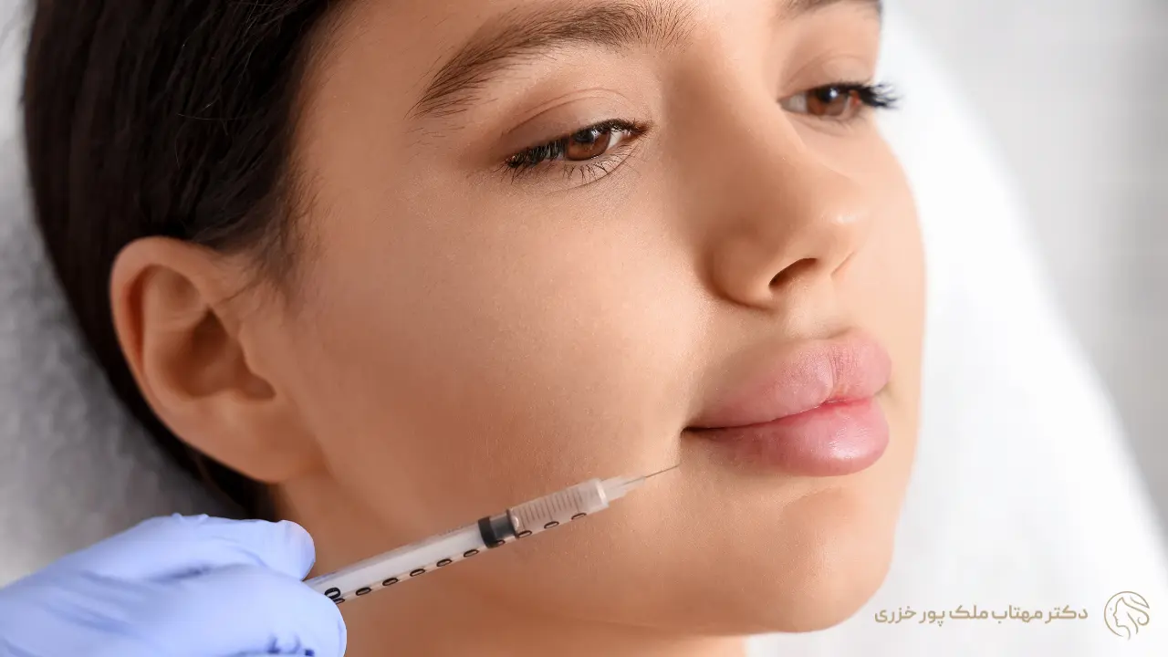 پایان دوران فیلر