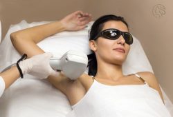 Underarm Laser Hair Removal