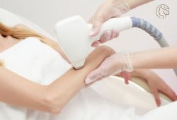 laser-hair-removal-on-hands