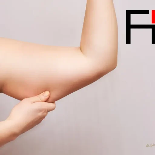 تایید FDA برای اولتراپی پرایم